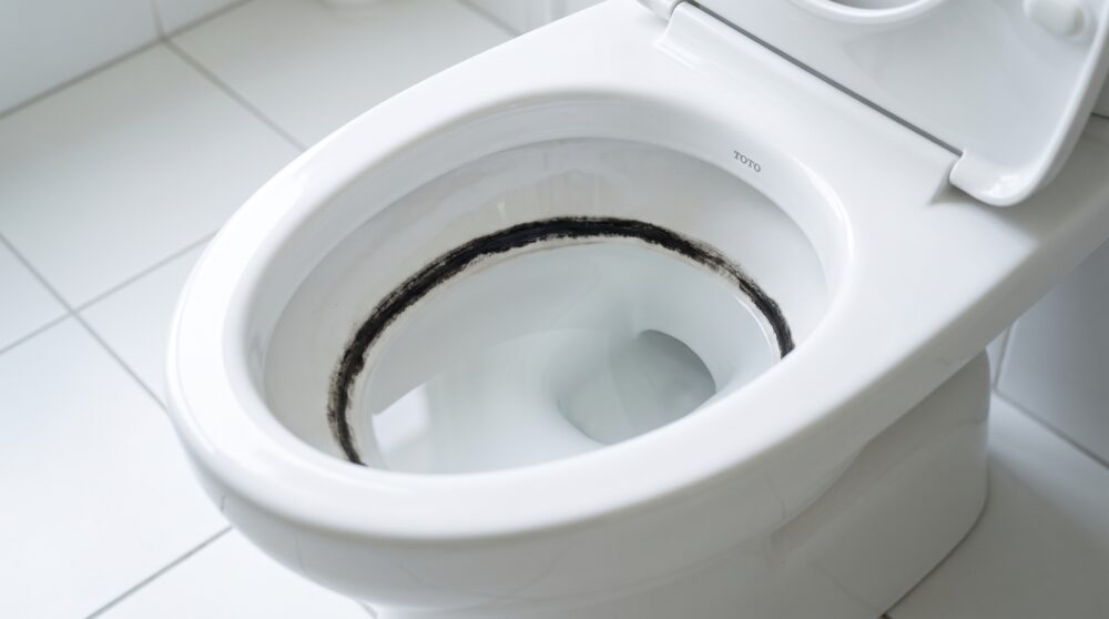 トイレの黒ずみはなぜできる？原因・落とし方・予防方法を徹底解説
